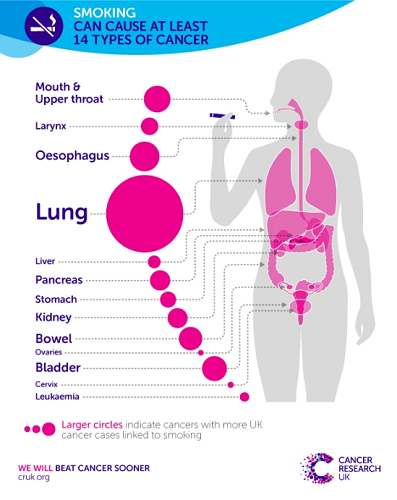 Lung Cancer Awareness Month UK